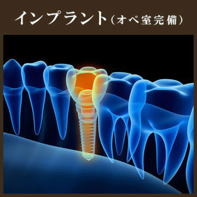 インプラント