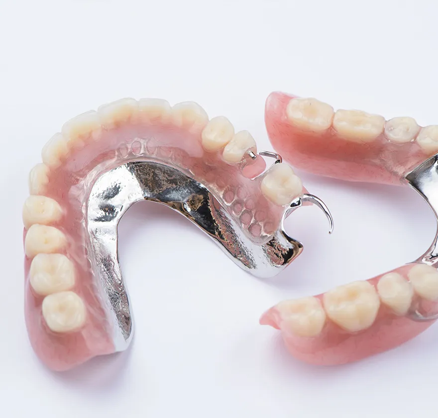 金属床の局部義歯(部分入れ歯)bg