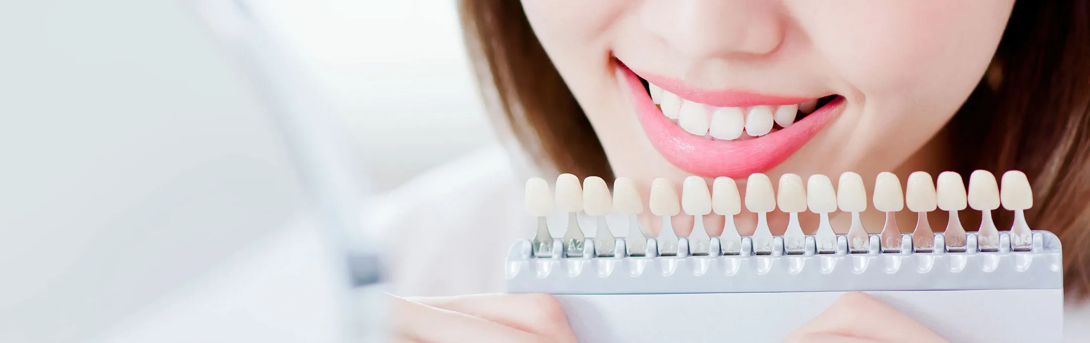 ホワイトニング