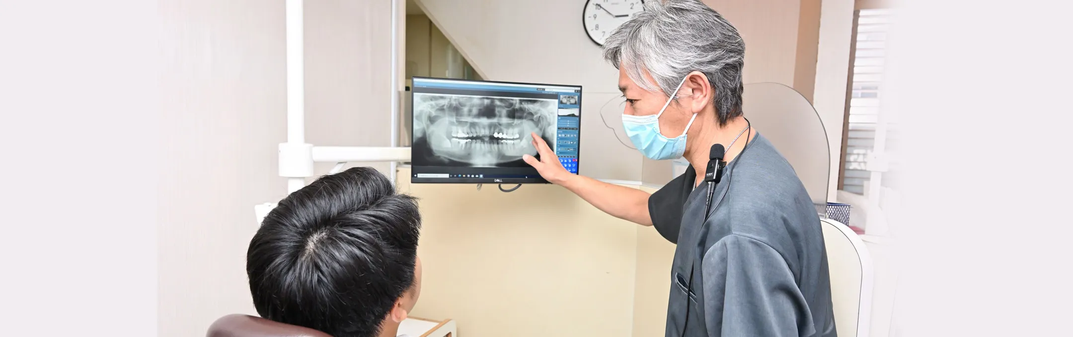 インプラントを選択するにあたって─カウンセリング─