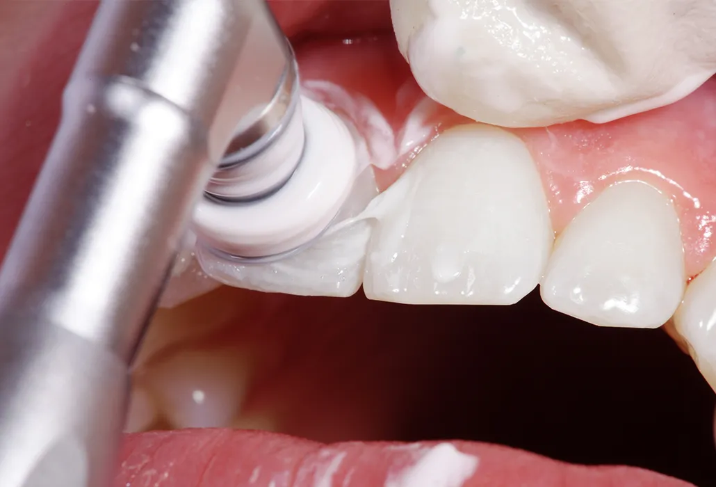 定期クリーニング