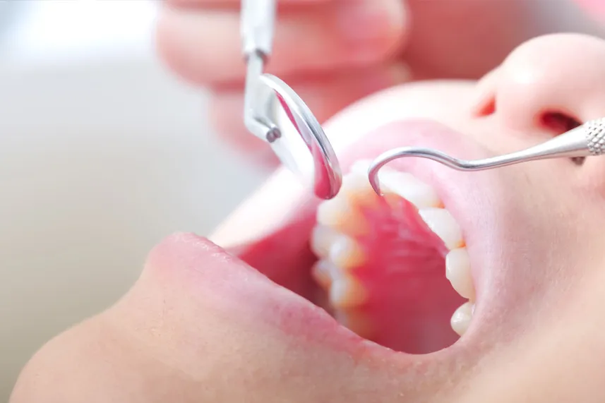 スケーリング・ルートプレーニング