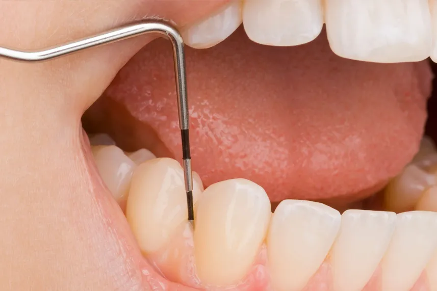 歯周外科・再生療法