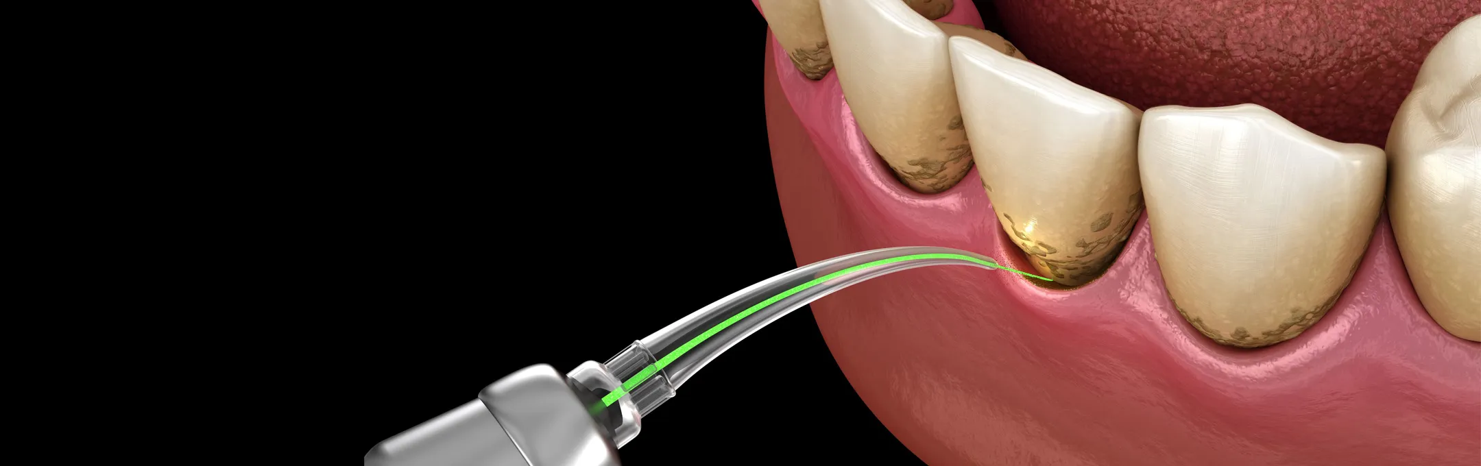 エムドゲインとは?
